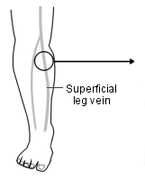 Venas de las piernas
