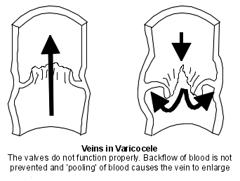 Válvulas venosas anómalas