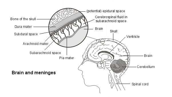 cerebro y meninges para explicar la hipertensión intracraneal idiopática