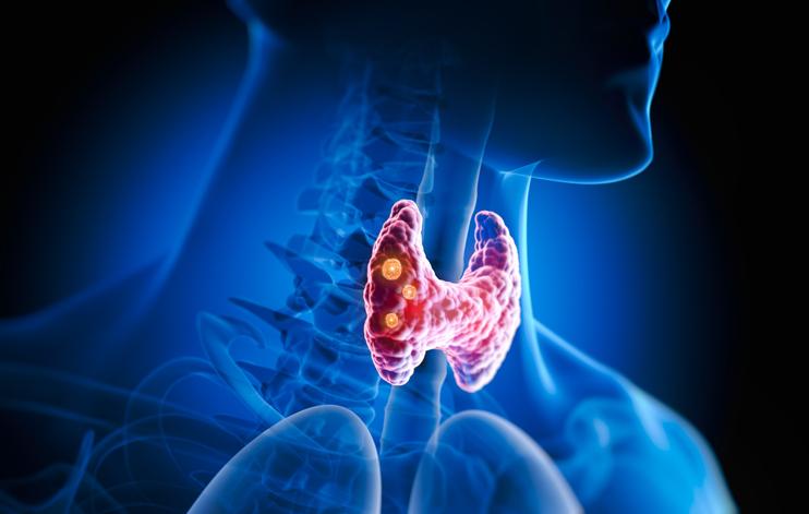 Glándula tiroides hipoactiva