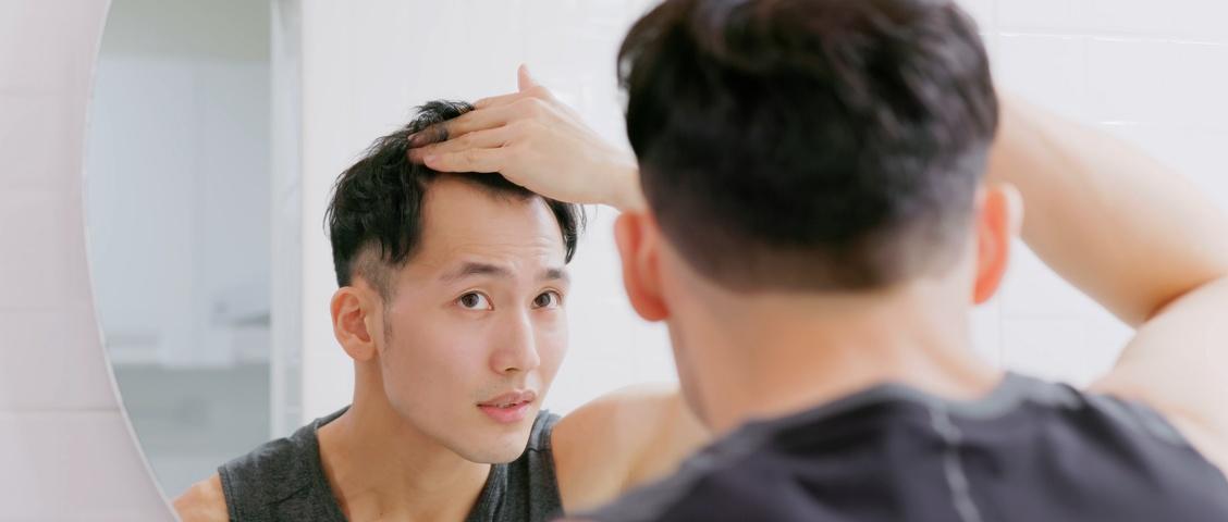 Man standing in front of mirror is concerned about hair loss or alopecia