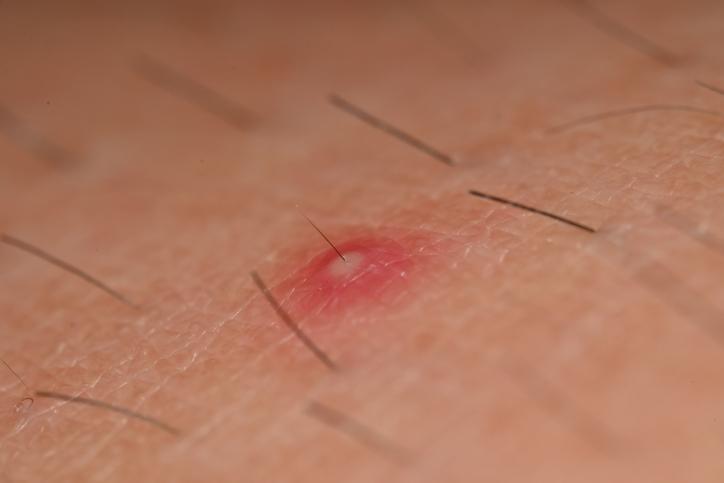 Imagen del artículo destacado