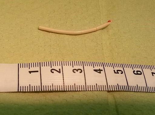 implante anticonceptivo Implanon