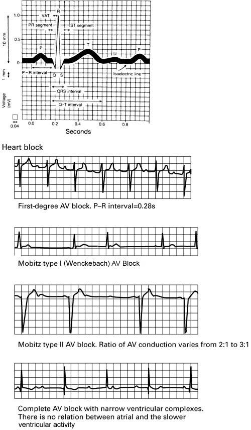 NOMENCLATURA ECG