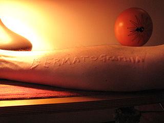 Urticaria dermatográfica