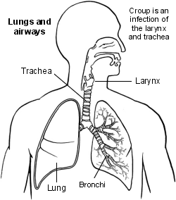 Pulmones y vías respiratorias crup