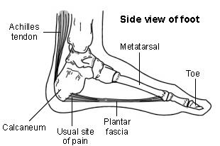 Talón - fascia plantar