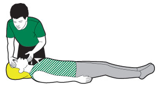 Abrir las vías respiratorias adulto