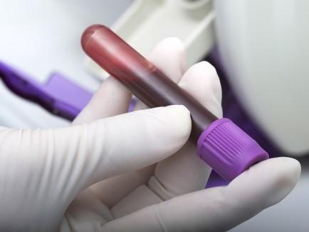 Pruebas de coagulación de la sangre