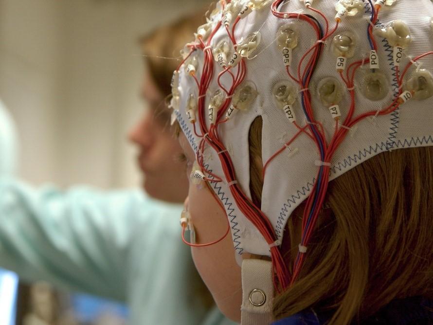 Tipos de crisis epilépticas