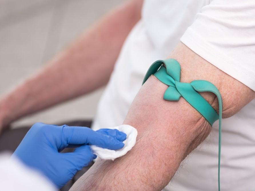 Preparación para la extracción de sangre