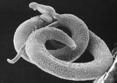 Schistosoma mansoni