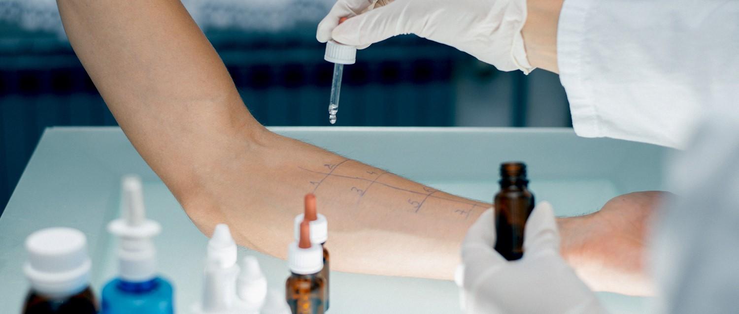 prueba privada de alergia