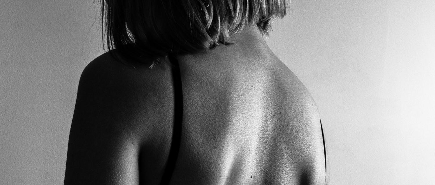 psoriasis y depresión