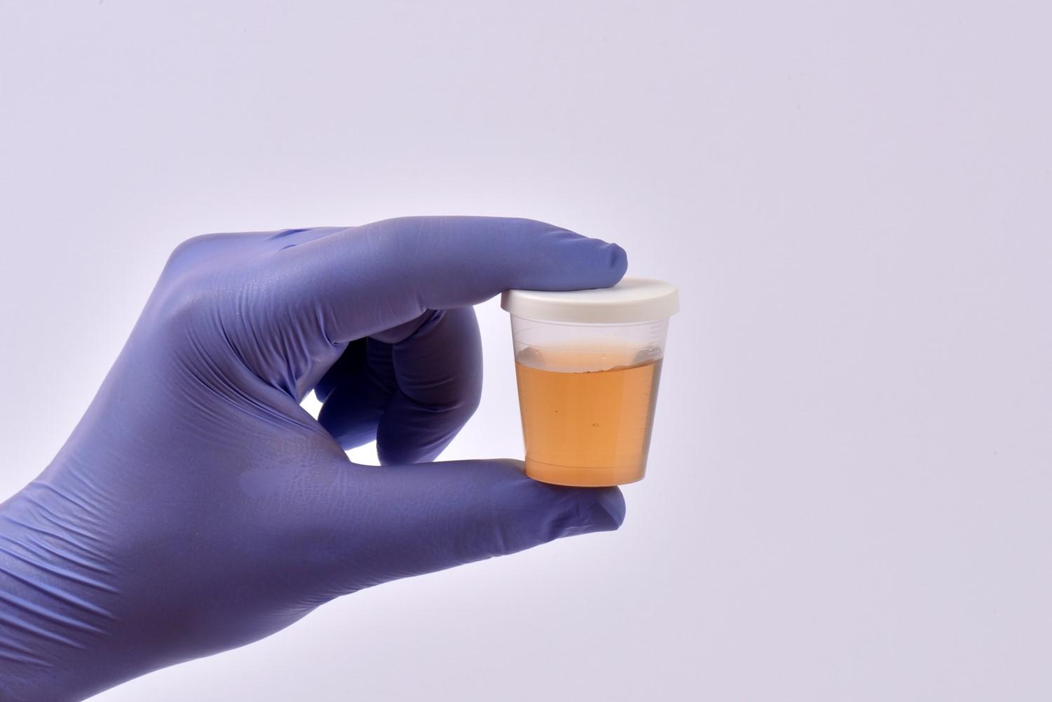 Imagen del artículo destacado