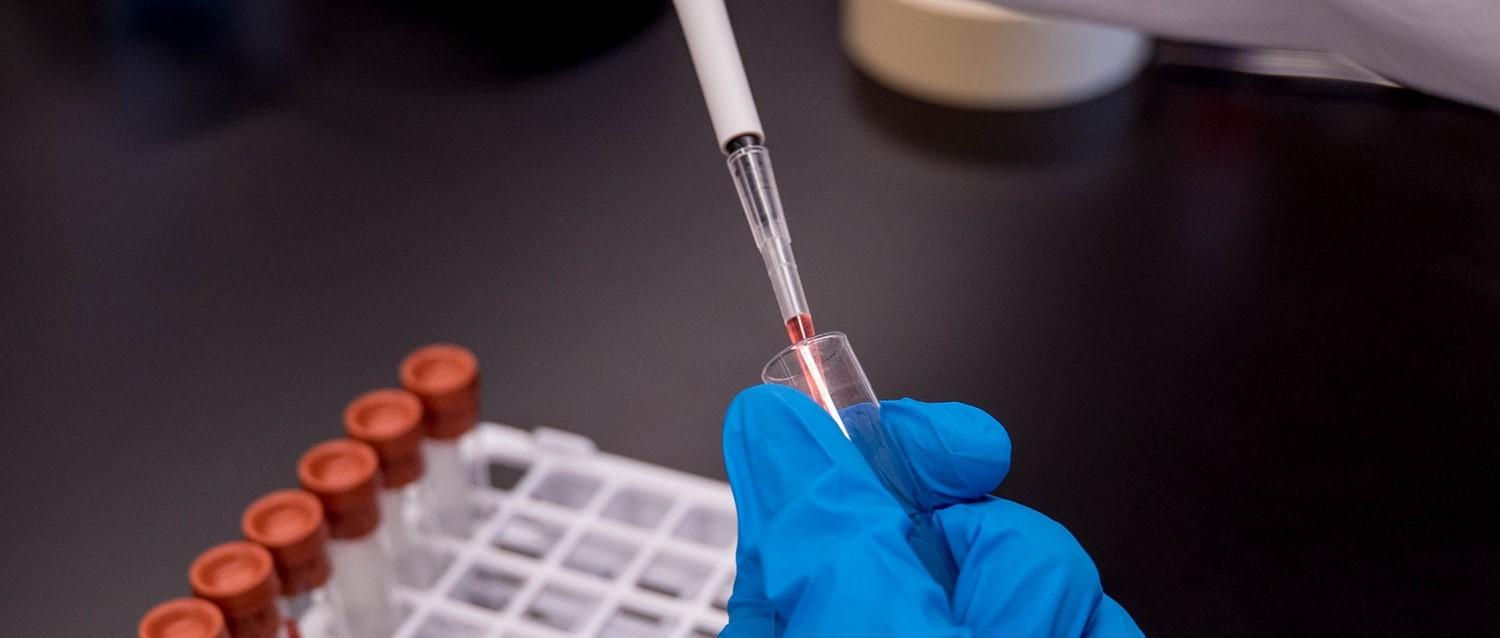 Estreptococo Una nueva cepa