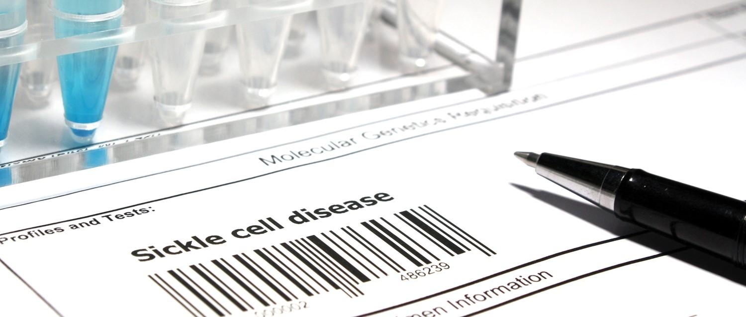 qué significa el nuevo tratamiento de la drepanocitosis para los enfermos de drepanocitosis