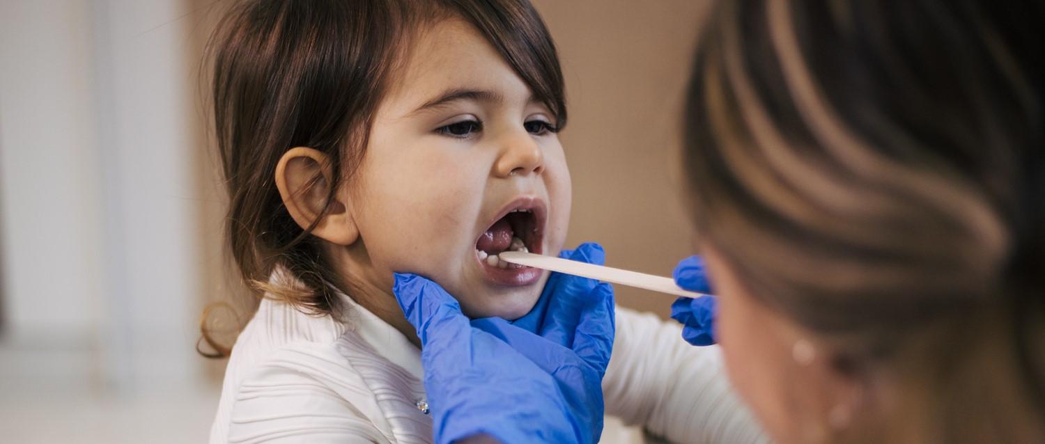 Cómo tratar la amigdalitis en los niños