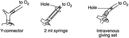 CRICOTIROIDOTOMÍA (2)